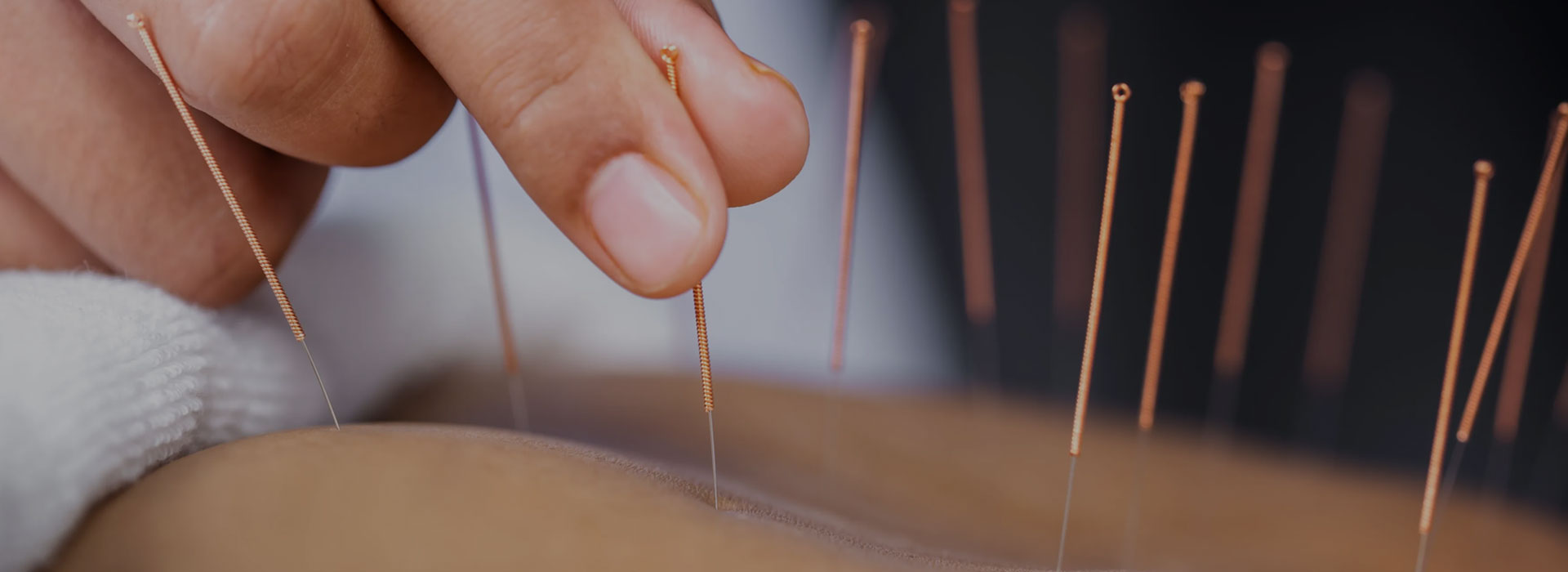 Acupuncture Clinic Calamvale