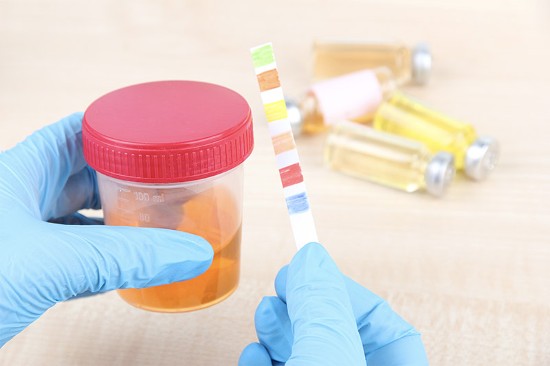 Urine Drug Test - Calamvale Central Family Practice